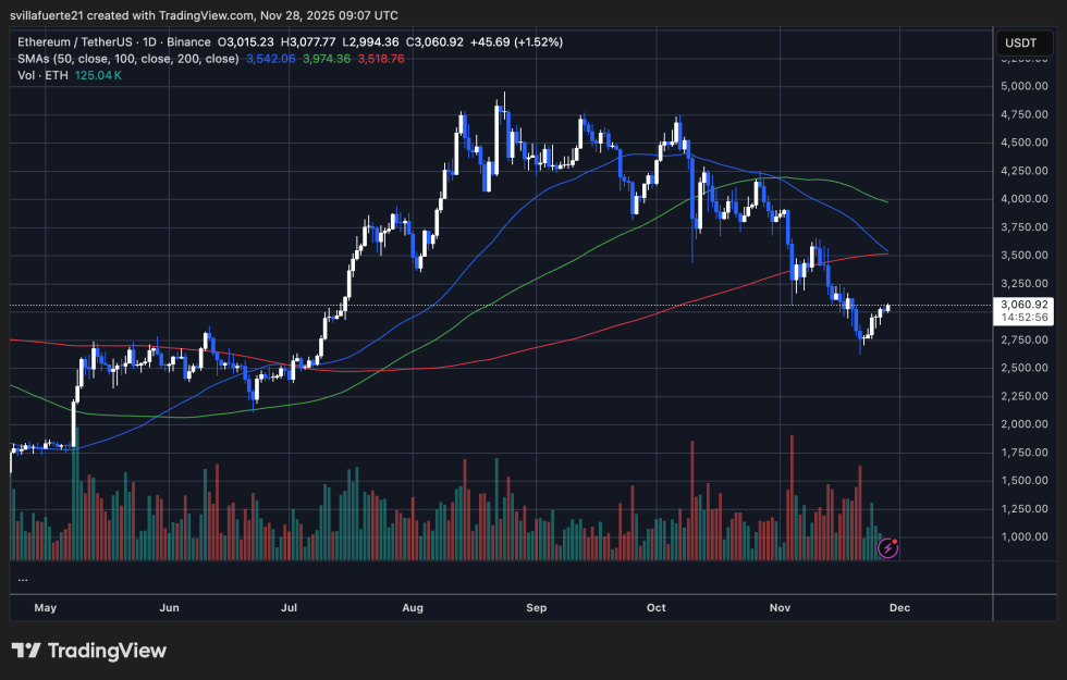 ETH consolidates around $3K level | Source: ETHUSDT chart on TradingView